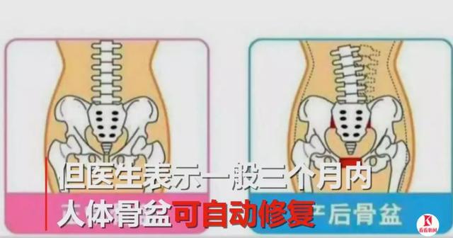 骨盆闭合与产后修复的区别（产后4个月做骨盆闭合后疼到跪地）(10)
